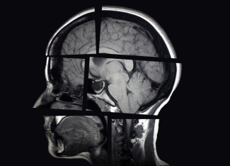 segmented x-ray of human skull