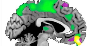 brain diagram