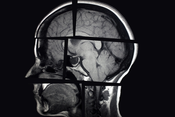 segmented x-ray of human skull